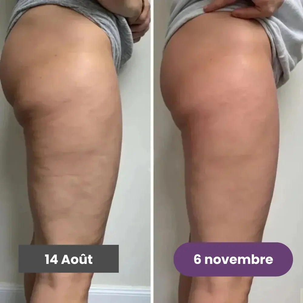 Leggings 3D Santavya – Redéfinissez votre silhouette sans effort